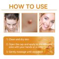 JIYAN2866 Gentle Bee Venoms Gel Bee Venom Skin Treatment Bee Venom Cream Fast-Acting Skin Treatment Cream All Skin Types. 