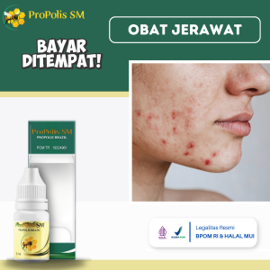Obat Jerawat Obat Pengempis Jerawat Obat Bekas Jerawat Jerawat Batu Obat Jerawat Bernanah Obat Bintik Hitam Di Wajah Obat Beruntusan Di Wajah Obat Penghilang Jerawat Obat Bopeng Jerawat Dengan Propolis SM