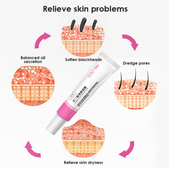 15% Azelaic Acid Anti-Acne Gel Salicylic Acid Pore Shrinking Cream ...