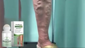 腿部护理滚珠 舒缓静脉曲张 促进血液循环 滋养保湿 | Leg Care Roller Massage Relieve Tired Legs | Penjagaan Kaki Melegakan Sakit Sendi