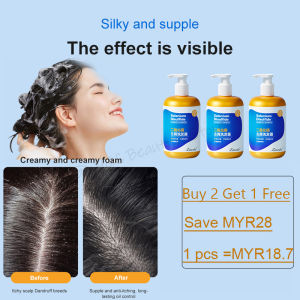 anti dandruff shampoo shampoo dandruff treatment oil control sea salt Shampoo Deep clean scalp reduce dandruff hair treatment removes mites Scalp Care scalp psoriasis Relieve itchy scalp Bald anti-itch/Oil Control/moisturizing/mite removal