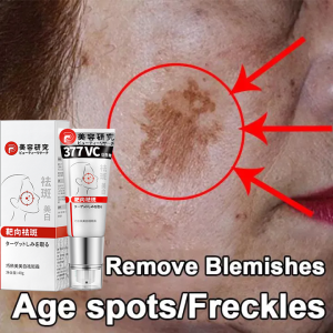 Japanese 40g Freckle remover cream effective whitening cream brightening Face whitening cream for men and women Removing Age Dark Spots Sun Freckles Bright Skin Care Removing Chloasma and Age Spots