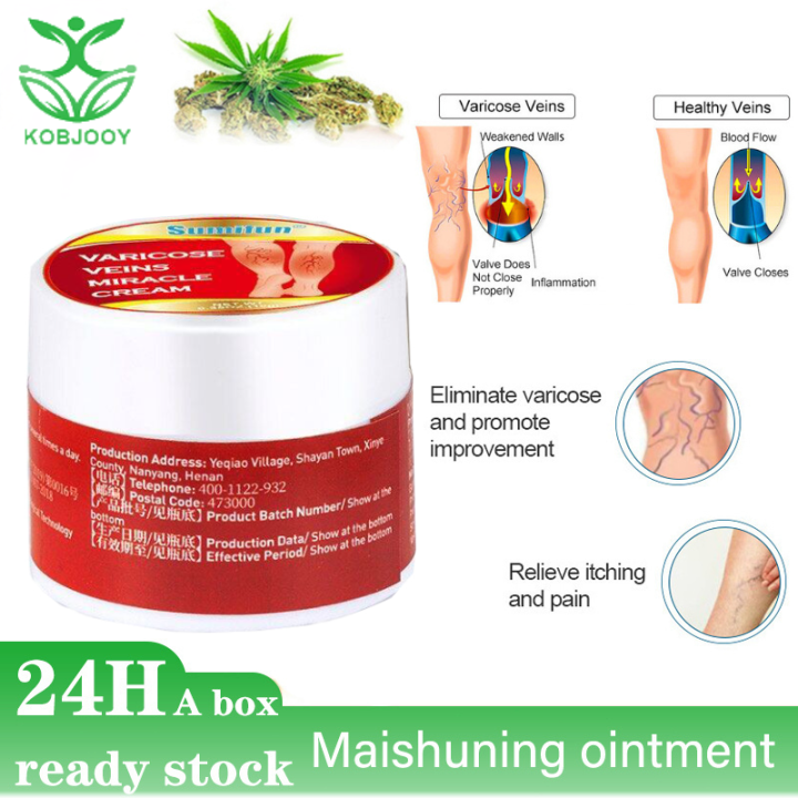 sumifun Ointment for treating varices, varicose ointment, ointment for ...