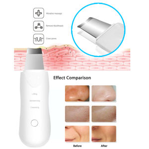 Cammuo Blackhead Remover Facial Skin Scrubber Pore Cleaner Wrinkles Remover Rechargeable Deep Face Cleaning Peeling Device