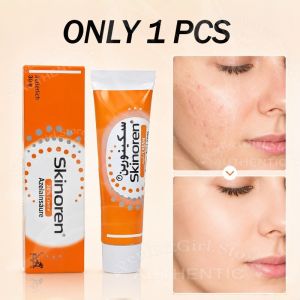 【BUY 1 TAKE 1】20% Azelaic Acid Cream 30g | Treats Acne And Pimples Fades Acne Scars Cleanses Pores For Facial Acne Redness And Pigmentation