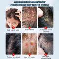 Anti dandruff shampoo，anti-itch shampoo，oil control shampoo 300ml Makes hair fresh, smooth, clean, sterilizes, and deeply cleans the scalp. It can be used by men, women, the elderly, and children.. 