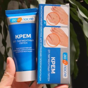 Kem Bôi Đồi Mồi Kpem Của Nga - Kem Dưỡng Giúp Mờ Và Hồi Phục Các Đóm Đồi Mồi Nám Tàn Nhan Kpem 50ml