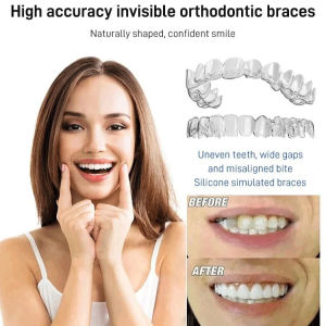 🦷 Fake Braces/Braces/Simulated Braces For Scientific Orthodontics Comfortable Fit Safe Silicone Material Orthodontic Yellow Teeth Adult Use Gap Correction Sixth Generation Simulated Braces