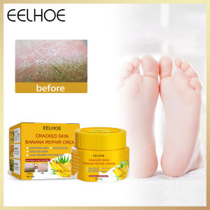 Eelhoe Banana Skin Repair Cream Anti-drying Crack Foot Cream Heel Cracked Repair Cream Removal Dead Skin Hand Feet Care Foot Mask Foot Crack Cream Heel Chapped Peeling Repair Anti Dry Crack Soften Foot Cream 20g