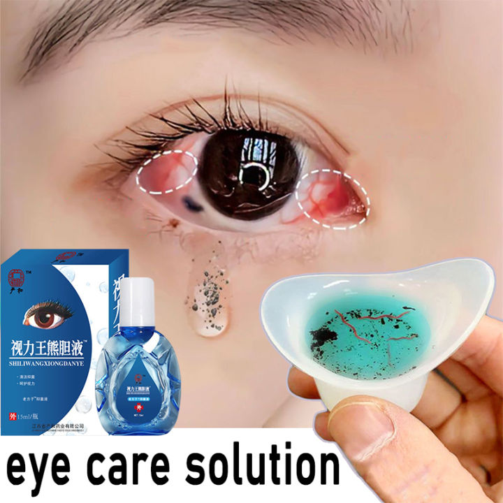 Fresh and Bright~YANHE® eye drops for clear vision 15ML,Relieve visual ...