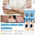 1 hari sembuh KADAI Salep Vitiligo 100% menghilangkan Menghambat Pertumbuhan Kulit Putih mengaktifkan melanin Meratakan Warna Kulit Untuk tubuh dan wajah formula jamu Tidak melukai kulit(vitiligo cream obat salep vitiligo vitiligo obat). 