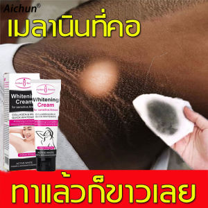 [มีสินค้าพร้อมจัดส่ง]Aichun ครีมทาขาหนีบ ครีมทารักแร้ดำ 50ml (รักแร้ดำคอดำ ครีมรักแร้ขาว โลชั่นผิวขาว ครีมบำรุงรักแร้ ครีมทารักแร้ขาว ทีทารักแร้ ครีมทาแก้คอดำ ครีมทาก้นดำลาย ครีมทาขาหนีบดำ ครีมทาผิวขาว)Whitening Cream