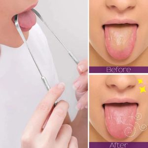 3Pcs/Set Alat Pembersih Lidah Sikat Lidah Stainless Steel Pengeruk Lidah Stainless Steel Dua Sisi Pembersih Lidah Bentuk Melengkung untuk Dewasa Anak-anak Meningkatkan Kondisi Mulut Mengurangi Bau Mulut