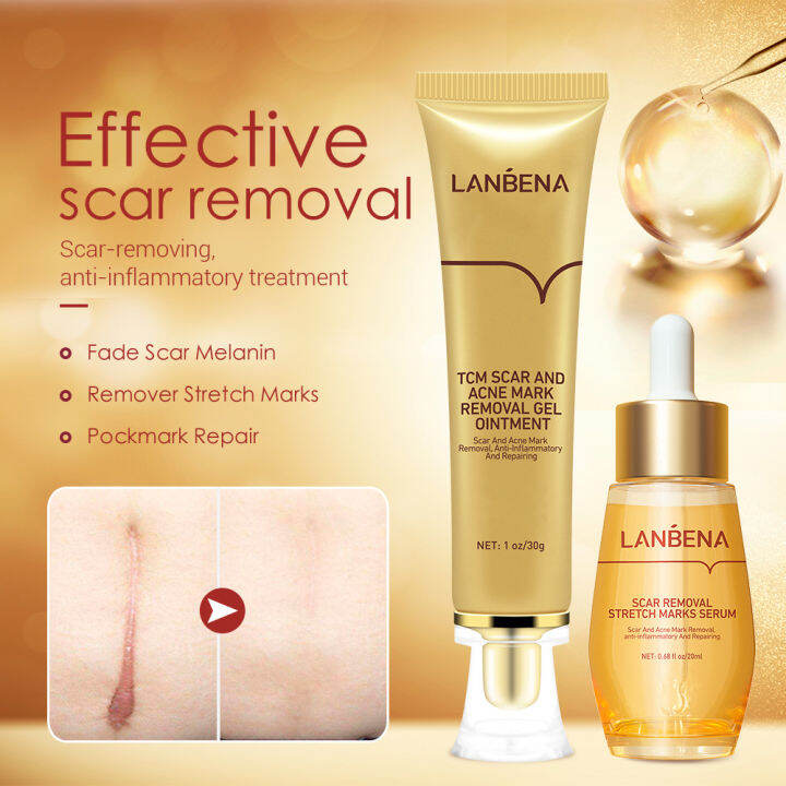 LANBENA Acne Scar Remove Serum Herbal Acne Treatment Cream Skin Repair ...