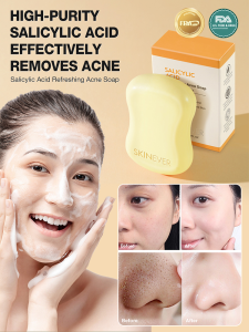 Salicylic Acid Soap Cleansing Mites Gentle Cleansing Soap