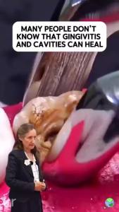 【HOT SALE!!!】Kreain Nature ยาสีฟันสมุนไพรฟลูออไรด์ ฟอกฟันขาวเร่งด่วน แก้ฟันเหลือง ลดเหงือกอักเสบ ป้องกันฟันผุ ขจัดคราบหินปูนเร่งด่วน