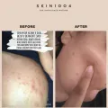 Kem Dưỡng Ẩm, Kiềm Dầu Dành Cho Da Mụn Skin1004 Madagascar Centella Soothing Cream 75ml. 