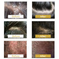 Anti dandruff shampoo，anti-itch shampoo，oil control shampoo 300ml Makes hair fresh, smooth, clean, sterilizes, and deeply cleans the scalp. It can be used by men, women, the elderly, and children.. 