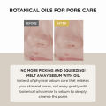 SKIN1004 Madagascar Centella Light Cleansing Oil (16ml/30ml/60ml/200ml/400ml). 