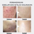 Exfoliating Gel Wajah Eksfoliasi Wajah Expoliasing Gel Wajah Peeling Gel Orange Exfoliating Whitening Gel Pengelupasan Kulit Mati. 