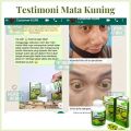 Obat Untuk Atasi Buta Warna, Obat Buta Warna Parsial, Obat Perawatan Mata, Obat Penglihatan Warna Berkuarang, Obat Buta Warna Ringan, Suplemen Untuk Peningkat Penglihatan Mata, Pencegahan Buta Warna, Obat Sulit Melihat Warna Yang Berbeda Dengan Keloreena. 