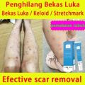 Penghilang Bekas Luka -Menghilangkan bekas luka lama di kaki-Menghilangkan bekas luka hitam-Menghilangkan bekas luka di wajah-Menghilangkan bekas luka lama-Cream penghilang bekas luka permanen-Cream penghilang bekas luka koreng hitam. 