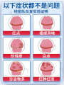 Erythromycin ointment medicine male balanitis special medicine foreskin inflammation fungal infection private anti-inflammatory ointment acne. 