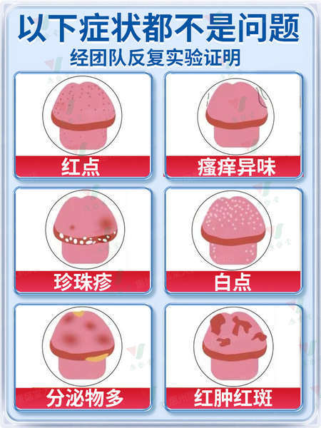 Erythromycin%20ointment%20medicine%20male%20balanitis%20special%20medicine%20foreskin%20inflammation%20fungal%20infection%20private%20anti-inflammatory%20ointment%20acne%20-%20Image%202