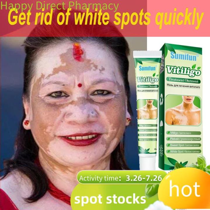 Happy Health Station Vitiligo Cream Vitiligo Treatment Ointment Skin Happy Health Station Vitiligo Cream Vitiligo Treatment Ointment Skin