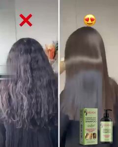 💯 ORIGINAL!EELHOE Hair Thickening Serum Moisturizing Hair Repairing Root Thickening Hairline Strengthening Hair Care Essence