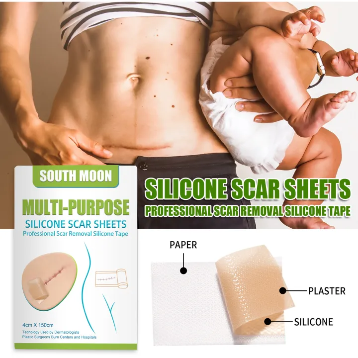 JKS%EF%BC%884*150cm%EF%BC%89South%20Moon%20Silicone%20Scar%20Sheet%20High%20Efficiency%20Surgical%20Silicone%20Gel%20Tape%20Removal%20Scar%20Tape%20Treatment%20-%20Image%207
