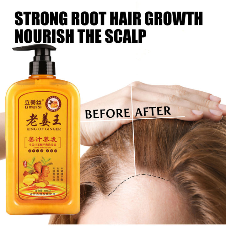Ginger Wang King of Ginger Anti Hair Loss Ginger Shampoo I Ginger Hair