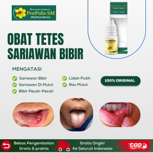 Obat Tetes Sariawan Di Bibir Obat Sariawan Mulut Obat Bibir Pecah-Pecah Obat Sariawan Anak Obat Lidah Putih Berjamur Dan Bau Mulut Dengan Propolis SM 6ml