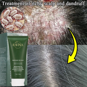 【RAVINIA】Anti dandruff scalp tonic extract 100g Powerful Dandruff Removal Itch Relief Folliculitis and Psoriasis Improvement Suitable
