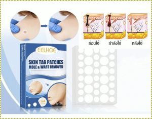 Mole and Skin Blemish Treatment  Clear and Protect Your Skin Complete Care Solution