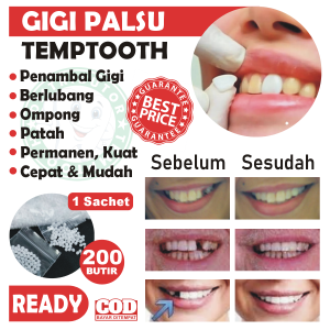 Temptooth ISI 200 Butir Gigi Palsu Permanen