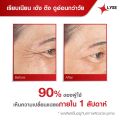 LYSE คู่หูหน้าเด้งคูณ 2 เซรั่มยกกระชับผิวหน้า + ครีมฟิลเลอร์ (30 กรัม) ของแท้ 100% ส่งฟรี!!!. 