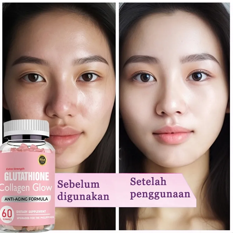 glutathione session cost Suplemen Memutihkan Kulit: Panduan Lengkap dan Efektivitasnya main image 1