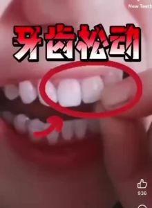 New Teeth Teeth Whitening Tooth Powder Antibacterial Cleaning Herbal Sensitive Ubat 神龈粉牙龈萎缩敏感口腔清洁牙齿亮白洁牙粉
