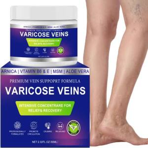 ครีมสำหรับเส้นเลือดขอด ครีมสำหรับเส้นเลือดและรักษาเส้นเลือดแมงมุมสำหรับขา ช่วยเพิ่มการไหลเวียนของเลือดและบรรเทาอาการขาที่เหนื่อยล้า สดชื่นและไม่เหนียวเหนอะหนะ 2 แพ็ค