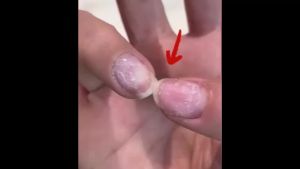 2 PCS 3 Days Nail Care Keratin Amino Acid Formula for Strengthening & Hydration ment for Dry Weak Fragile Nails