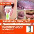 Obat Tetes Herpes Mulut Menahun, Luka Melepuh Sekitar Bibir, Benjolan Di Bibir, Polip Gusi dan Gigi, Herpes Bibir Bengkak, Gatal, Infeksi Jamur Di Rongga Mulut, Infeksi Virus Herpes Simpleks, Herpes Oral, Salep Bibir Borok Herbal Alami, Dengan Propolis SM. 