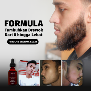 Sigviolet Serum Penumbuh Brewok - Sigviolet Hair Growth Serum - Sigviolet Serum Penumbuh Rambut - Sigviolet Hair Growth 100% Original