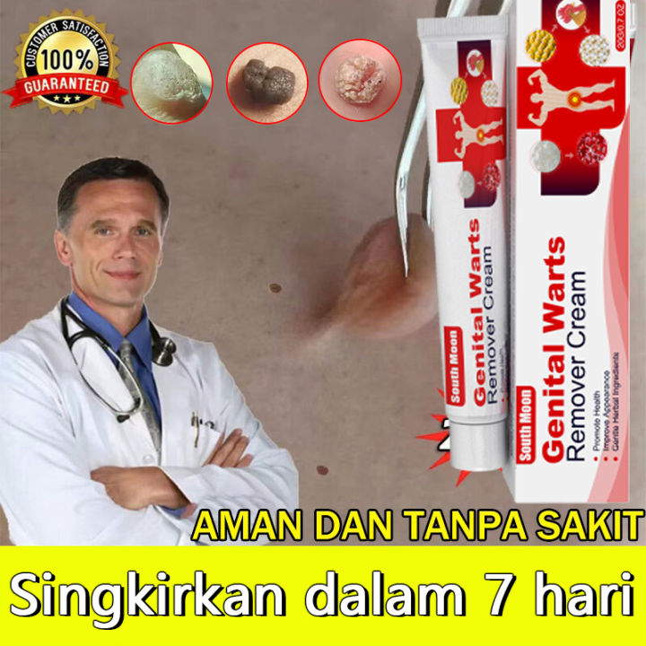 Ubat Buang Kutil Ketuat Tahi Lalat Biji Kolestrol Genital Wart Herpes