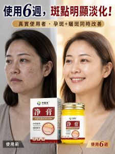 Plant Essence Spot Removal Cream Spotless Cream For Women Plant Essence Face Spotless Cream/Anti-Dark Spot Treatment/Skincare