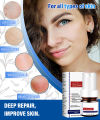 Dark Spot Correcting Brightening Serum Reduce Dark Spots Hyperpigmentation Lightening Acne Dark Patches Essence. 