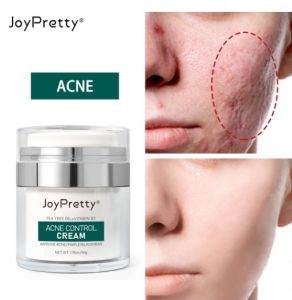 Original JoyPretty 50Grm Cream Mencegah Mengurangi Jerawat  Pelembab  Organik Pemutih Kulit