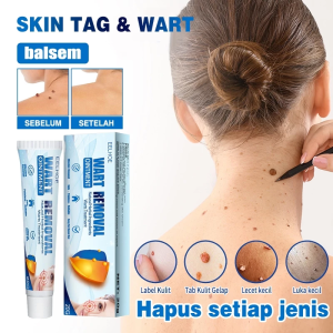 Krim Penghilang Kutil & Tahi Lalat Efektif untuk Penghilang Kutil Wajah dan Mata Ikan 20g