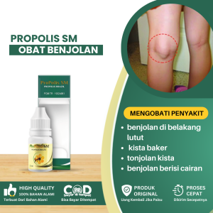 Obat Benjolan Di Belakang Lutut Obat Penghilang Benjolan Di Lutut Obat Kista Baker Lutut Kiri Kanan Obat Penghancur Tonjolan Kista Pada Persendian Obat Benjolan Berisi Cairan Benjolan Lipoma Di Kaki / Tangan - Propolis SM