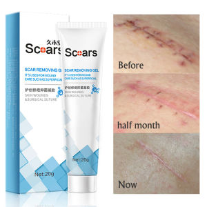 ครีมกำจัดรอยแผลเป็นจากสิว Body Face Scar Repair Gel Burn Bruises เครื่องหมายยืดเร่งการเจริญเติบโต Moisturizing Skin